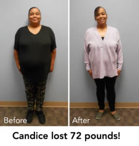 Candice lost 72 lbs