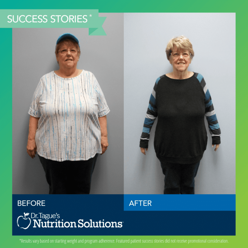 Dr. Tague Weight Loss Success Story - Susan 67lbs in 9mos